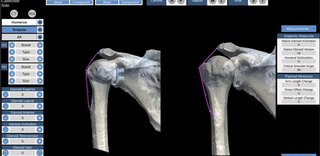 360 LINK – KNEE NAVIGATION project preview
